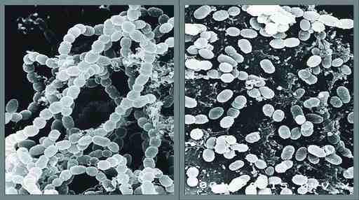 Цепи бактерий до (слева) и после применения ультразвуковых волн (справа на фото)